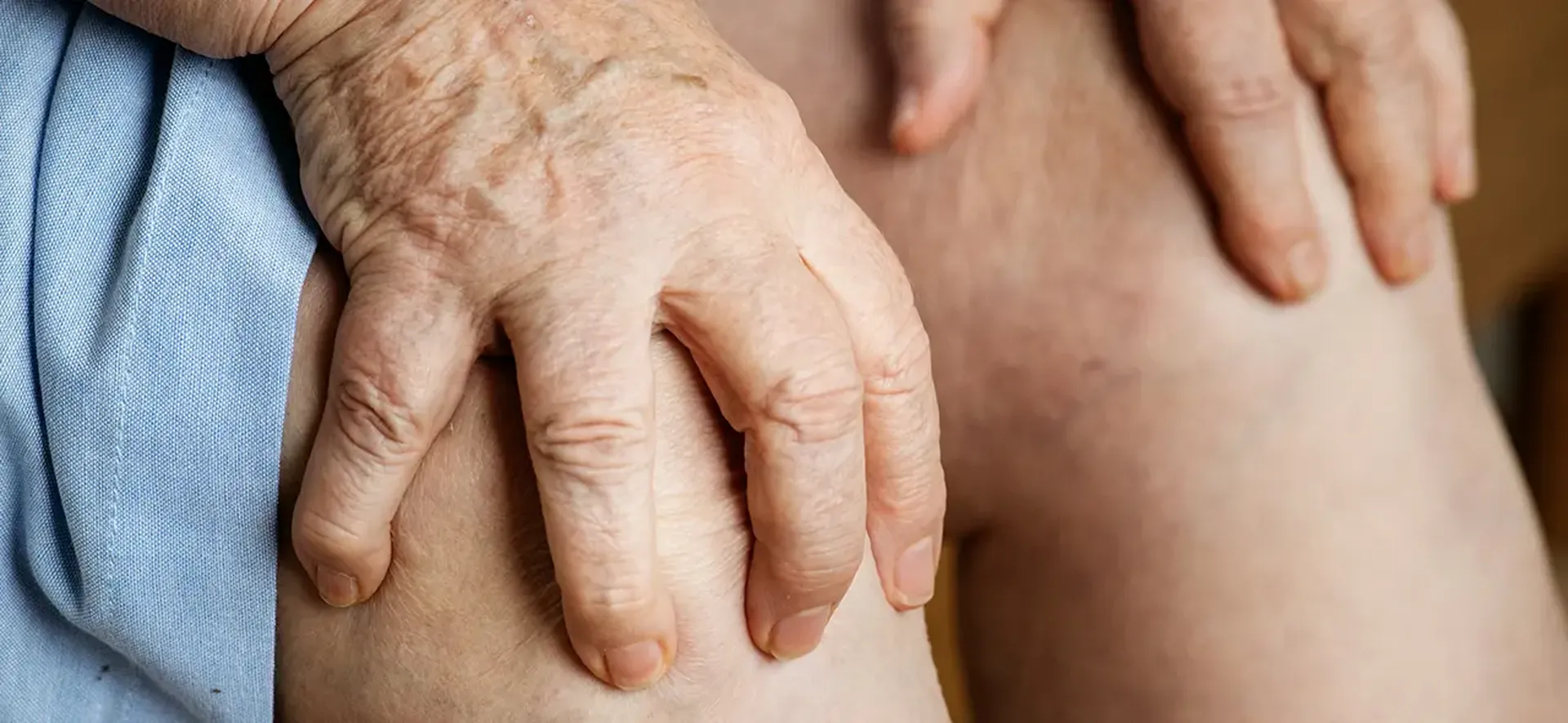 Artrite reumatoide: diagnóstico e tratamento imediato são fundamentais para controle da dor nas articulações