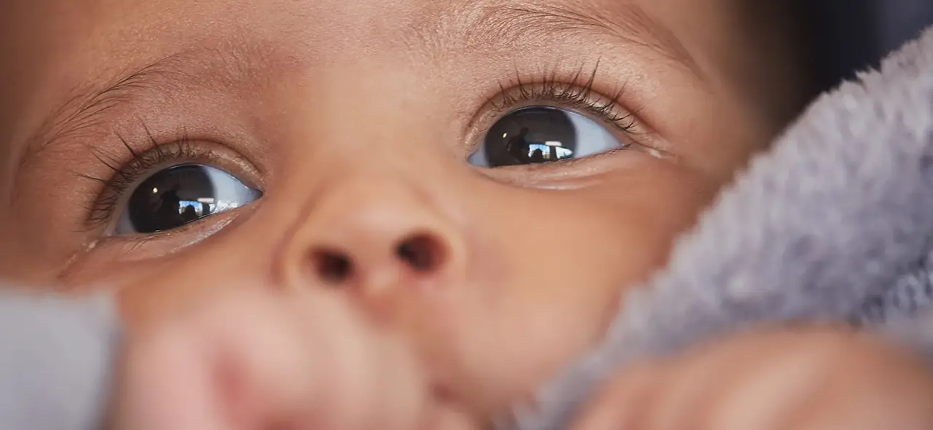 Diagnóstico precoce do retinoblastoma previne cegueira infantil