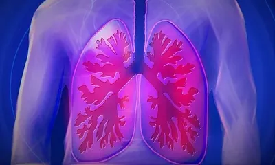 Doenças respiratórias na estação da seca são destaque no próximo webinário de temas emergentes na APS