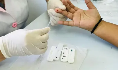 Segunda edição do Manual Técnico para Diagnóstico da Sífilis está disponível para consulta pública