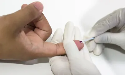 Estado de SP promove webinário sobre sífilis congênita e criança exposta à doença para profissionais de saúde
